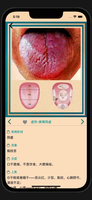 中医舌诊宝典iPhone版截图5