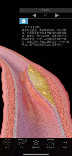 生理和病理学iPhone版截图3