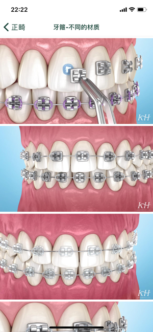 口腔图谱iPhone版截图8