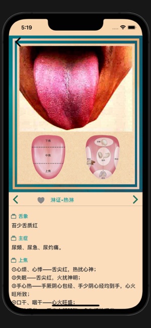 中医舌诊宝典iPhone版截图6