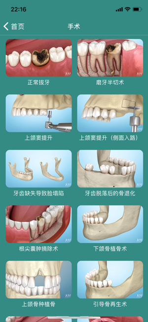 口腔图谱iPhone版截图6