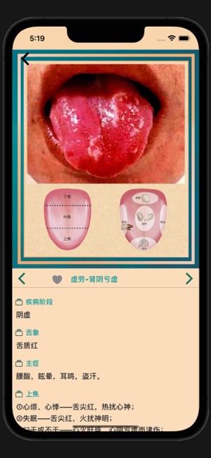 中医舌诊宝典iPhone版截图7