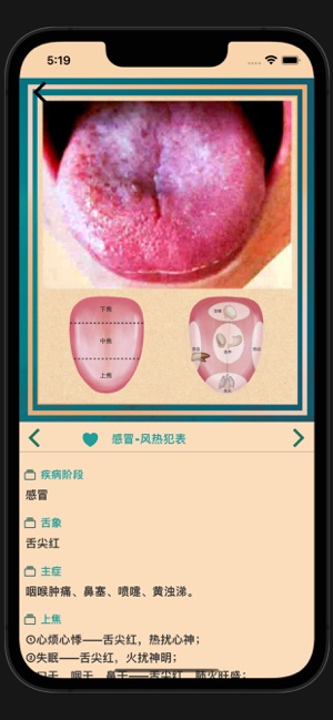 中医舌诊宝典iPhone版截图3