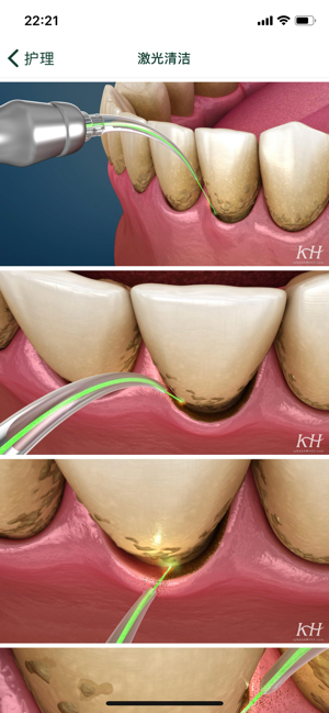 口腔图谱iPhone版截图10