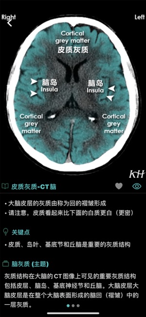 影像图谱iPhone版截图8