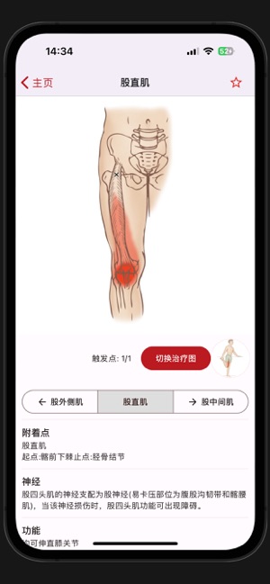 疼痛触发点iPhone版截图5