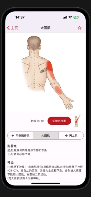 疼痛触发点iPhone版截图3